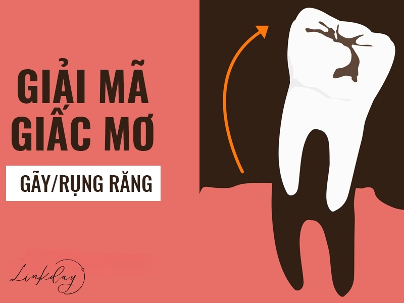 Read more about the article Bật mí 7 ý nghĩa khi nằm mơ thấy rụng răng